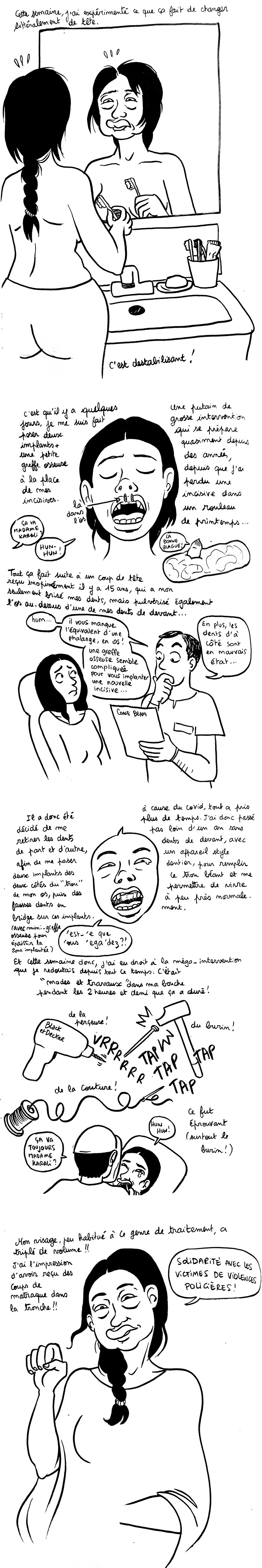 http://melaka.free.fr/blog/implants.jpg